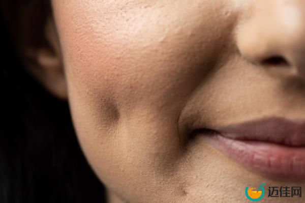Woman smiling with dimples
