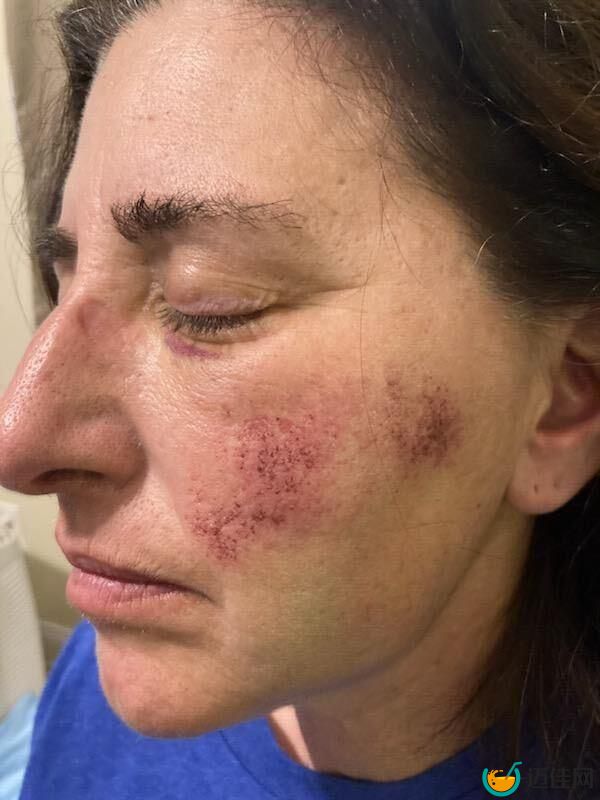 Naydich shows off her facial wounds following the attack.