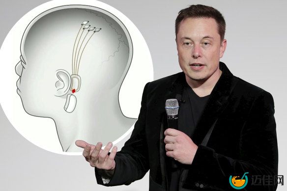 Elon Musk is making big promises a<em></em>bout his medical start-up.
